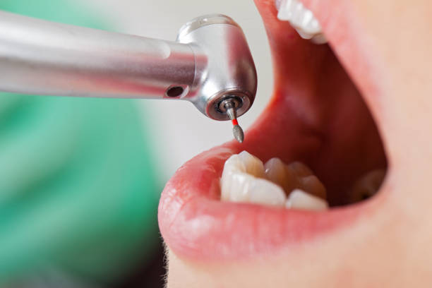 Best Weekend Emergency Dentist in Cambridge, MN